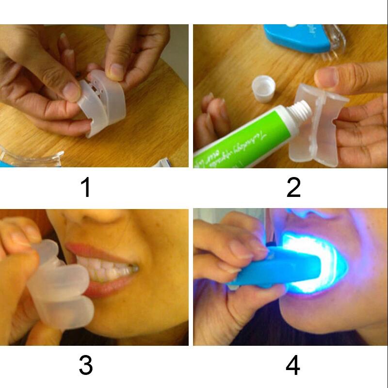 Kit de Blanchiment Dentaire